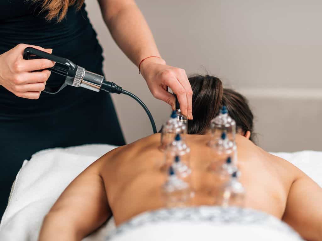 Cupping